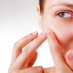 Продукты в борьбе с прыщами — диеты