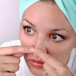 Диета от черных точек на лице — диеты