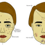 Что сахар, алкоголь и глютен делают с вашим лицом? — диеты