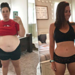 Похудела ради дочки: как я сбросила 50 кило и зачем решилась на пластику живота