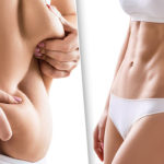 Сушка — зачем она тем, кто худеет? — диеты